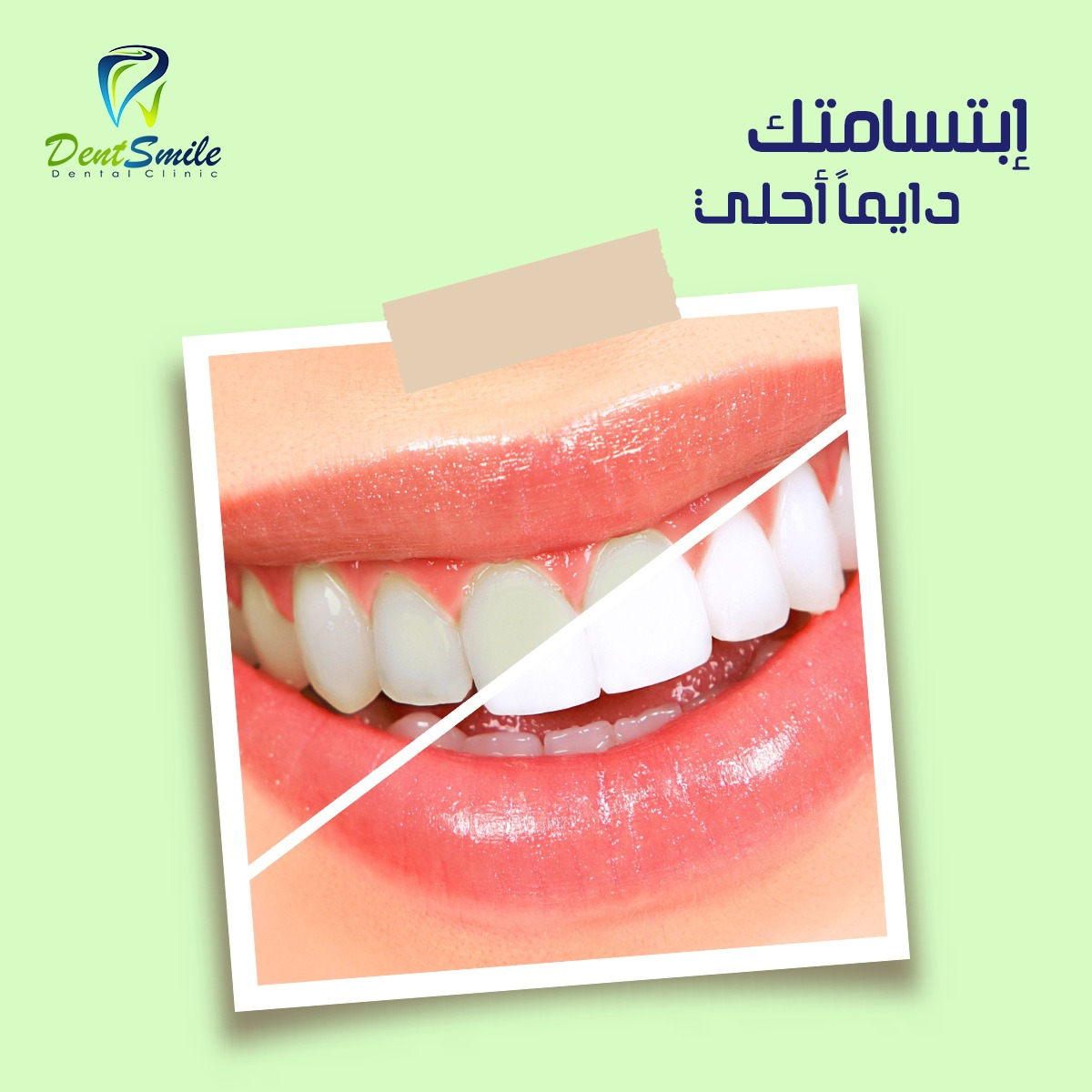 dent smile - Event Image 12