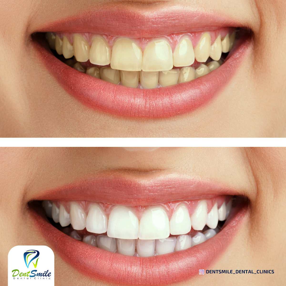 dent smile - Event Image 14