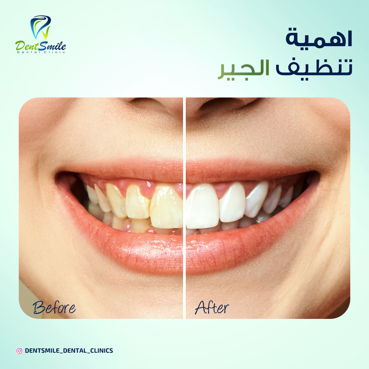 dent smile - Event Image 20