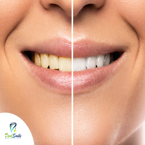 dent smile - Event Image 6